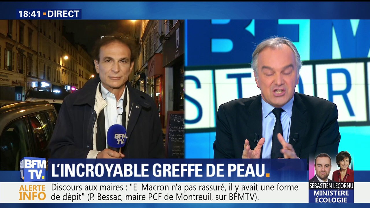 Un homme sauvé grâce à la greffe de peau de son jumeau