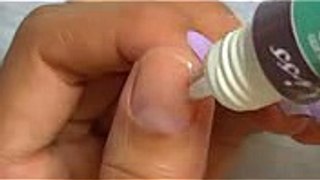 How to fix a broken nail