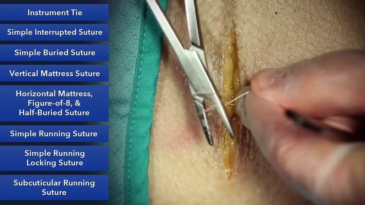 Instrument Based Sutures