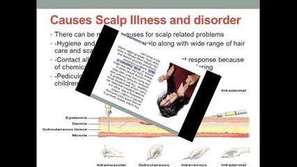 Scalp Treatment In Delhi