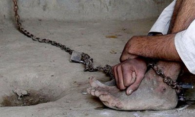 Alami Penyempitan Tulang, Pria Ini Harus Dipasung