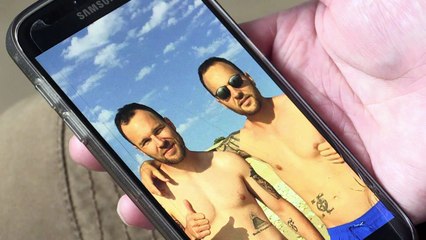 Burn victim saved by skin grafts from identical twin