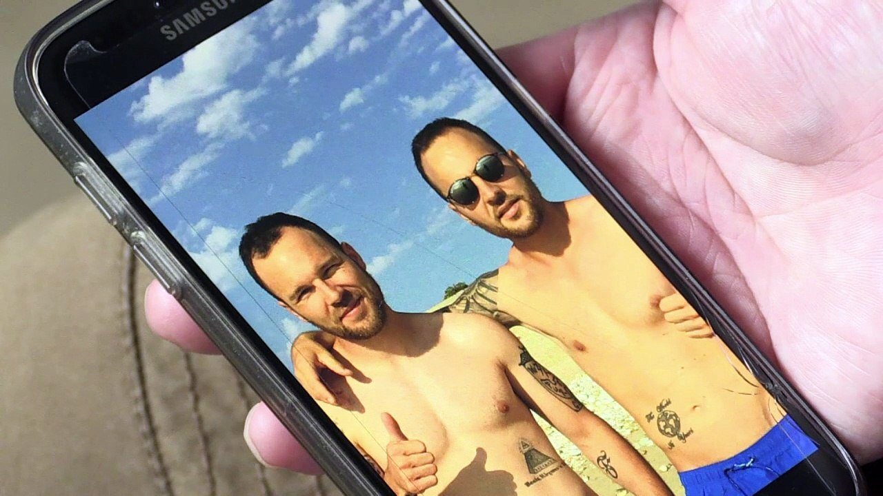 Burn victim saved by skin grafts from identical twin