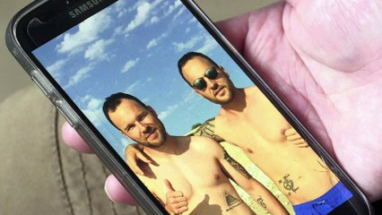 Exitoso trasplante de piel procedente de su hermano gemelo