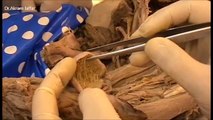 What is Inside Your Testicles - Testicles Dissection- Medical Videos