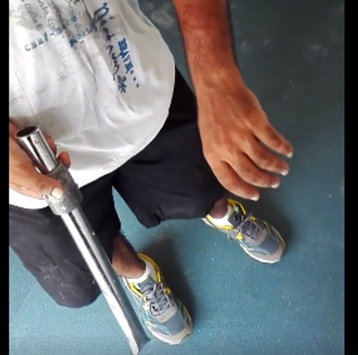 Manus Island Refugee Claims He was Beaten With Pole by Local Authorities