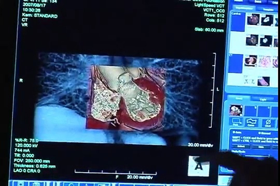 AIMMS LIBRARY VIDEO 2 OF CT SCAN Slice CT Scan