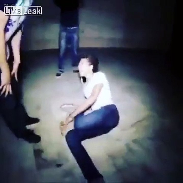 Skater falls on skateboard and breaks his leg.