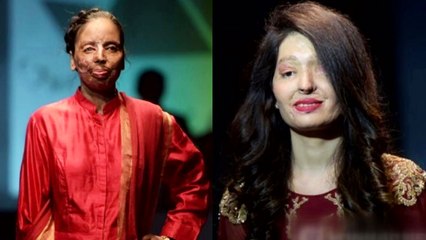 '염산 테러' 아픔 딛고 패션쇼 무대에 서다 / YTN