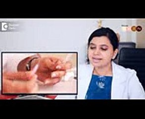 What is thread lift treatment for anti aging - Dr. Amee Daxini