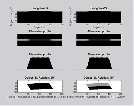 AIMMS LIBRARY VIDEOV NO 14 CT Animation - Computed Tomography How to generate sinograms in a CT scanner