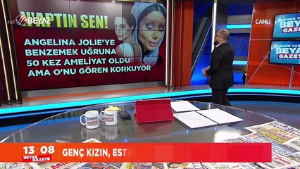 50 estetik ameliyat geçirdi, O'nu gören korkuyor!