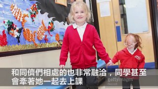 她是全球最小「只有68公分」拇指姑娘，醫生說她活不到1歲，但她上小學後竟然「發生了奇蹟」！