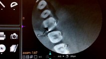 aimms library ct scan course video no 15 Cone-Beam Computed Tomography Image