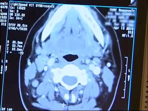 AIMMS LIBRARY VIDEO NO 18 CT SCAN COURSE CT (Computed Tomography) Scan What to expect