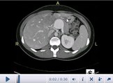 AIMMS LIBRARY VIDEO NO 19 CT SCAN COURSE CT abdomen -Anatomy