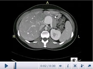 AIMMS LIBRARY VIDEO NO 19 CT SCAN COURSE CT abdomen -Anatomy