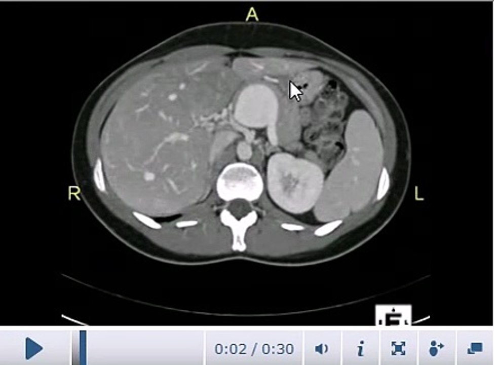 AIMMS LIBRARY VIDEO NO 19 CT SCAN COURSE CT abdomen -Anatomy