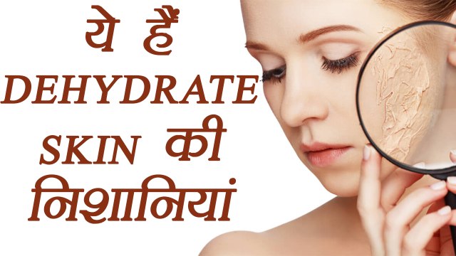 Skin Dehydration Symptoms | स्किन डिहाइड्रेशन को ऐसे पहचानें | Boldsky
