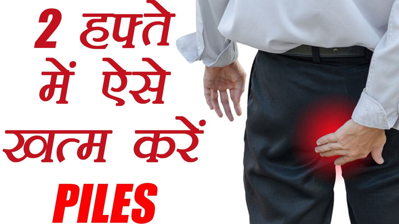 Home Remedies for piles/Hemorrhoids | बवासीर के घरेलू उपचार | Boldsky