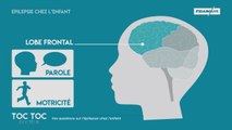 Où naissent les crises d'épilepsie dans le cerveau ?