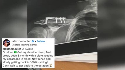 Alexander Gustafsson Underwent Surgery, Will Enter Extensive Rehab