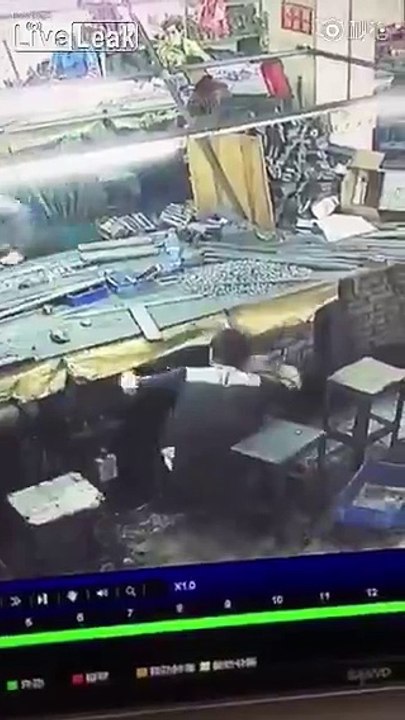 Worker scalped nice and clean by machine