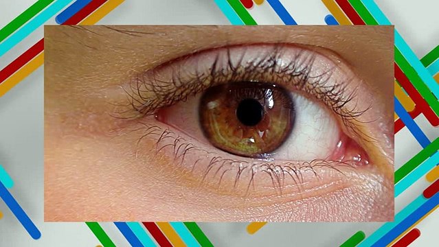 Lo que dicen los ojos de su salud