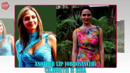 Download Video: 8 Bollywood Actresses Who Looks Horrible Post Cosmetic Surgery - You Won't Believe