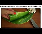 Aloe Vera to Treat Eczema, Psoriasis, Dermatitis and Other Skin Allergies