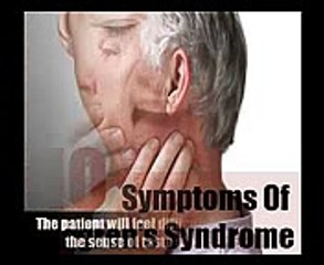 10 Major Symptoms Of Sjogren's Syndrome