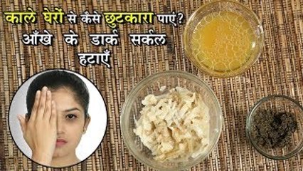 काले घेरों से कैसे छुटकारा पाए ? आँखों के डार्क सर्किल हटाए | Home Remedy For Dark Circle In Hindi