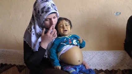 Doğuştan Karaciğer Yetmezliği Çeken Minik Şerzan Nakil Olmazsa Ölecek