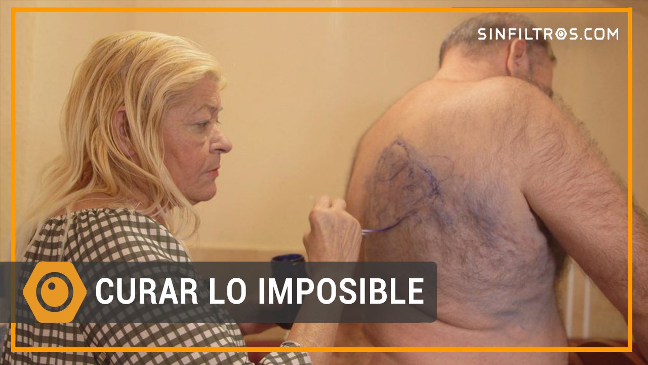Curar lo imposible | Sinfiltros.com