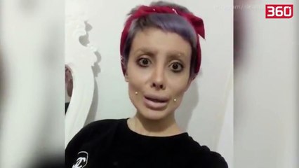 Donte ti ngjante Angelina Jolie, por shikoni se si është shpërfytyruar kjo vajzë nga operacionet (360video)