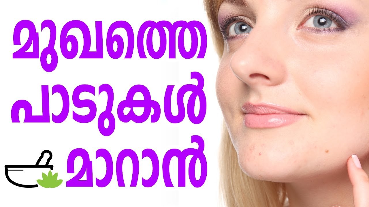 മുഖത്തെ പാട് മാറ്റാന്‍ ചില നുറുങ്ങുവിദ്യകള്‍ how to remove blackheads,how to remove pimples,how to remove dark circles,how to remove pimple marks
