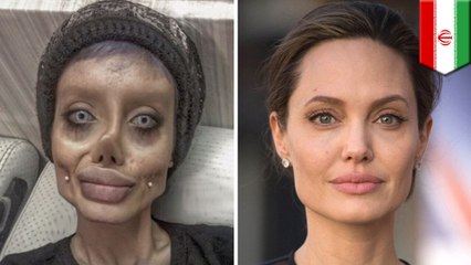 Teen says she got 50 surgeries to transform into Angelina Jolie