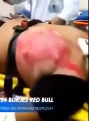 24 Adet Redbul İçen Adamın Kalp Atışlarındaki Değişiklik