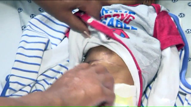 Insurance Companies Deny Claims for Life-Saving Donor Breast Milk for Premature Babies