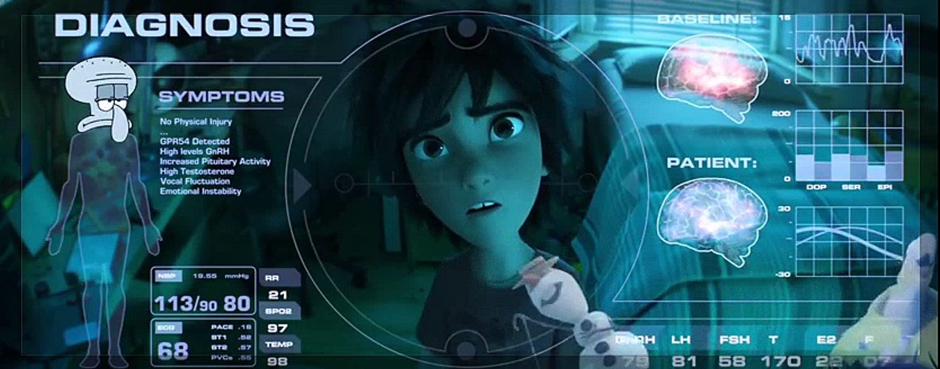 YTP Malfunctioning Baymax ( Big Hero 6 crack Parody )