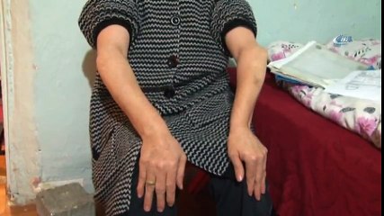 Cam Kemik Hastası Aile Yardım Eli Bekliyor