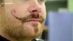 Holidaymaker potentially scarred for life - by a henna tattoo MOUSTACHE.