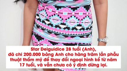 Cô gái trải qua hàng trăm cuộc phẫu thuật nuôi ước mơ người mẫu