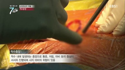 메디컬 다큐 7요일 - 평범한 일상을 꿈꾸며- 초고도비만 외_#002