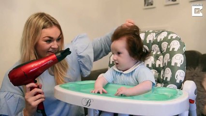 Ce bébé est né avec beaucoup de cheveux.. Surnommé bébé Wolverine