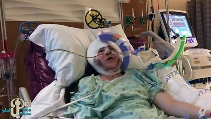 استهزؤا بها لانها ولدت بنصف وجه .. و لكن بعد 30 سنة جعلتهم يندمون جميعآ .. شاهد كيف اصبحت اليوم !!