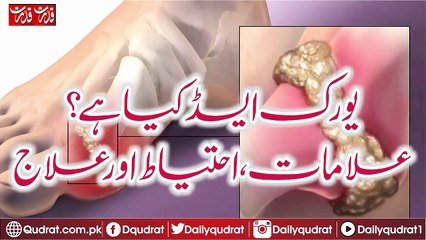 What is uric acid and their treatment