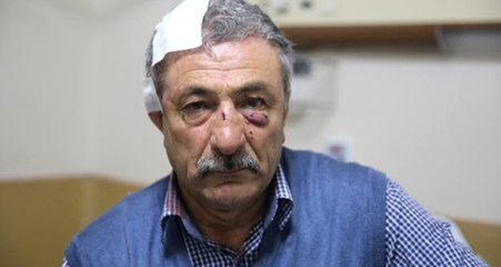 FETÖ Şüphelisinin Ağabeyi, "Kardeşimi Şikayet Ettin" Diyerek Esnafı Hastanelik Etti