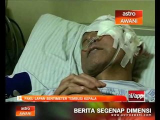 Paku 8 sentimeter tembusi kepala