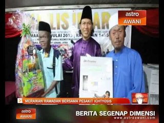 Meraikan Ramadan bersama pesakit ichtyosis
